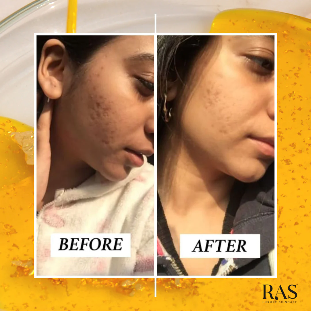 Saffron Glow + Hydration Kit for Bright Dewy Skin - Image 7