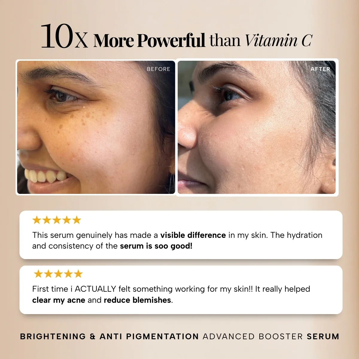 Brightening & Anti Pigmentation Advanced Booster Serum - Image 5