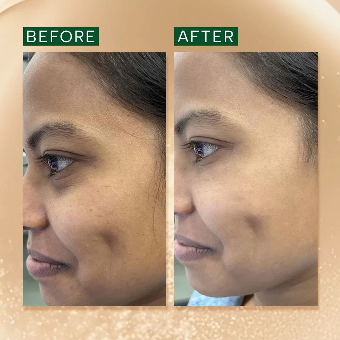Brightening & Anti Pigmentation Advanced Booster Serum - Image 9