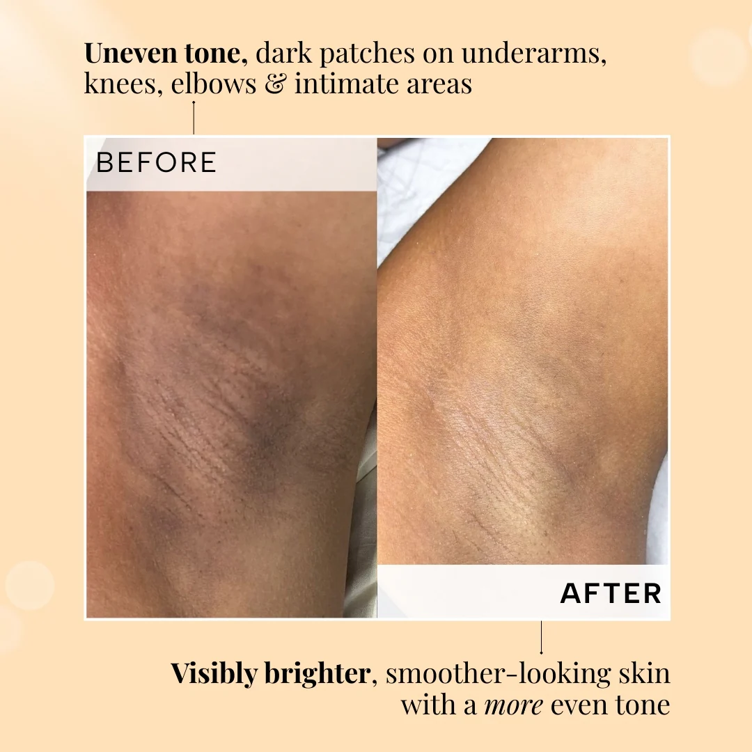 Flaunt Anti-Pigmentation Serum for Neck, Elbow, Underarms & Knees - Image 6