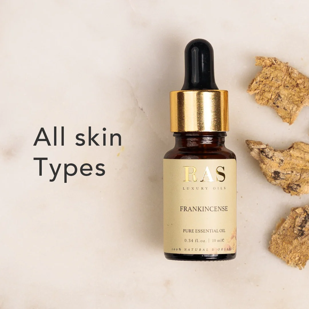Frankincense Pure Essential Oil - Image 4