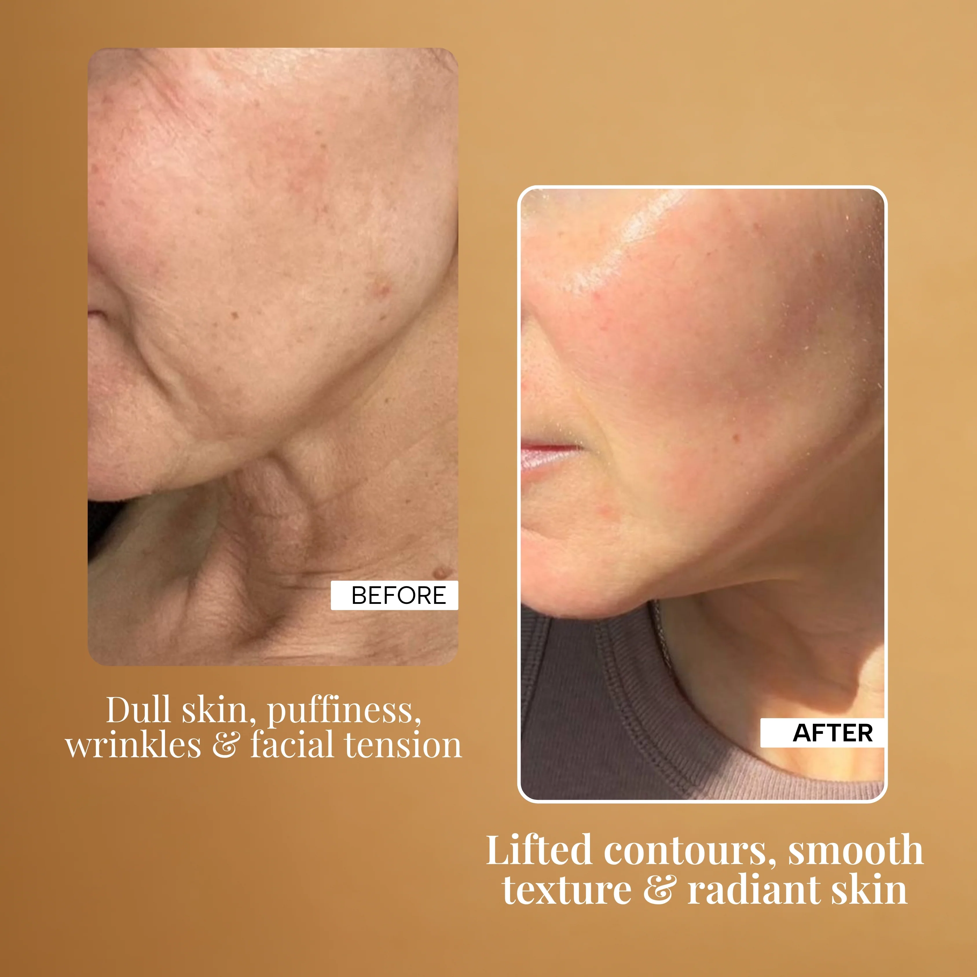 GlowLift 4-in-1 Electric Massager for Wrinkles, Sagging skin & Dark Circles - Image 4