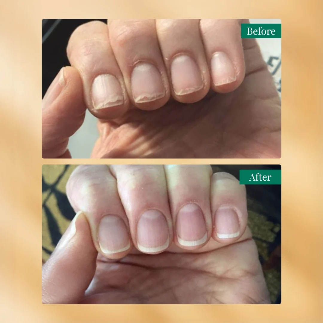 Nailchemy™ Strengthening Nail Serum - Image 6