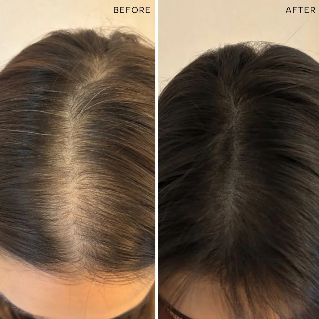 Root-ine™ Hair Elixir with 30 Regenerative Botanicals - Image 7