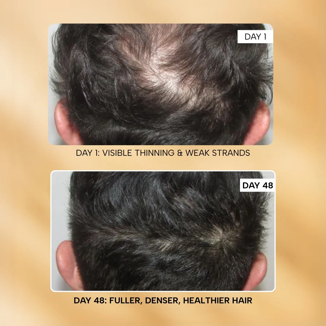 RAS™ Root-ine™ Hair Growth Serum with 19.5% Scalp Actives - Image 10