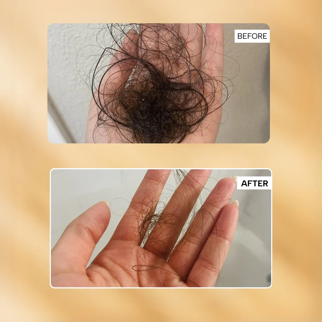 RAS™ Root-ine™ Hair Growth Serum with 19.5% Scalp Actives - Image 11