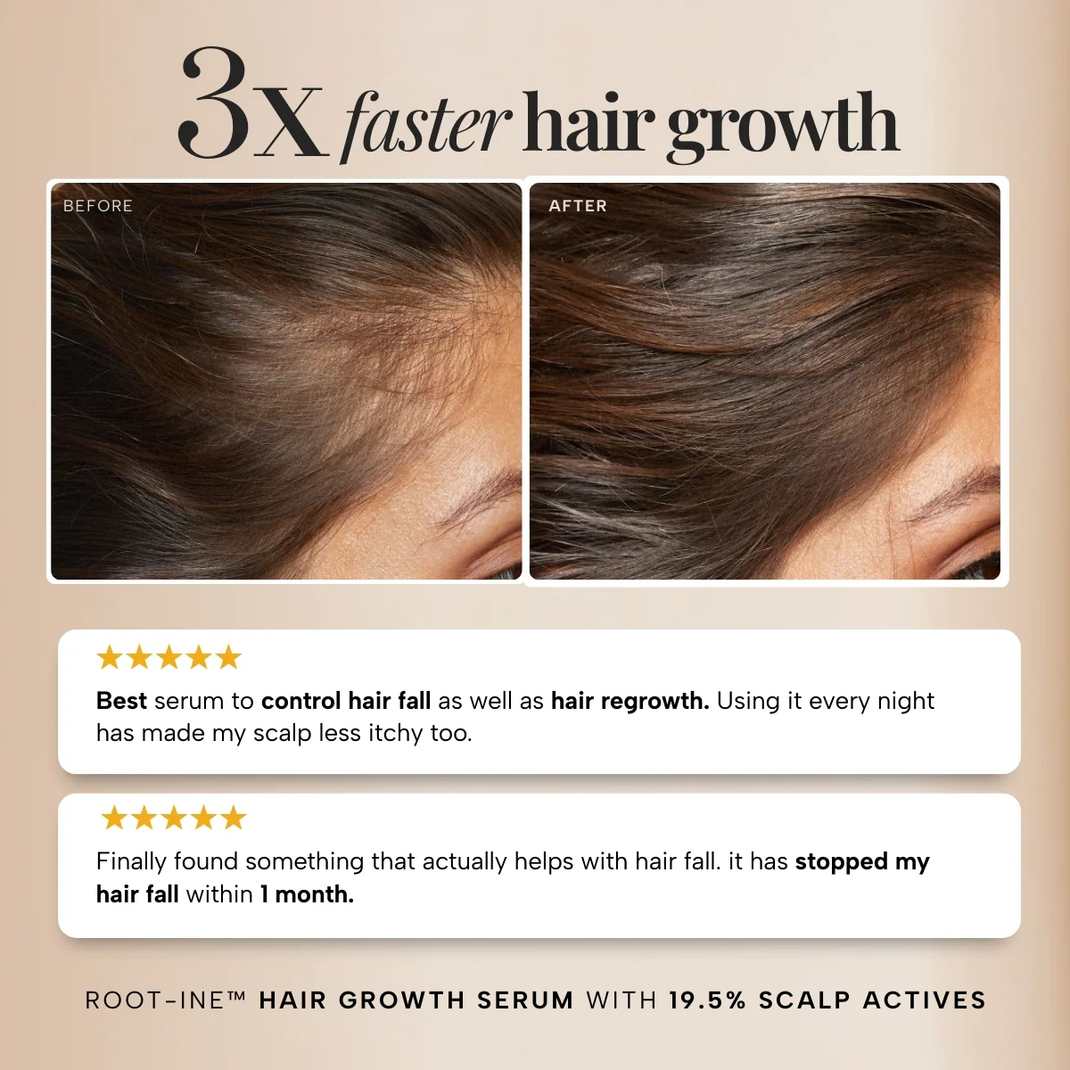 RAS™ Root-ine™ Hair Growth Serum with 19.5% Scalp Actives - Image 22