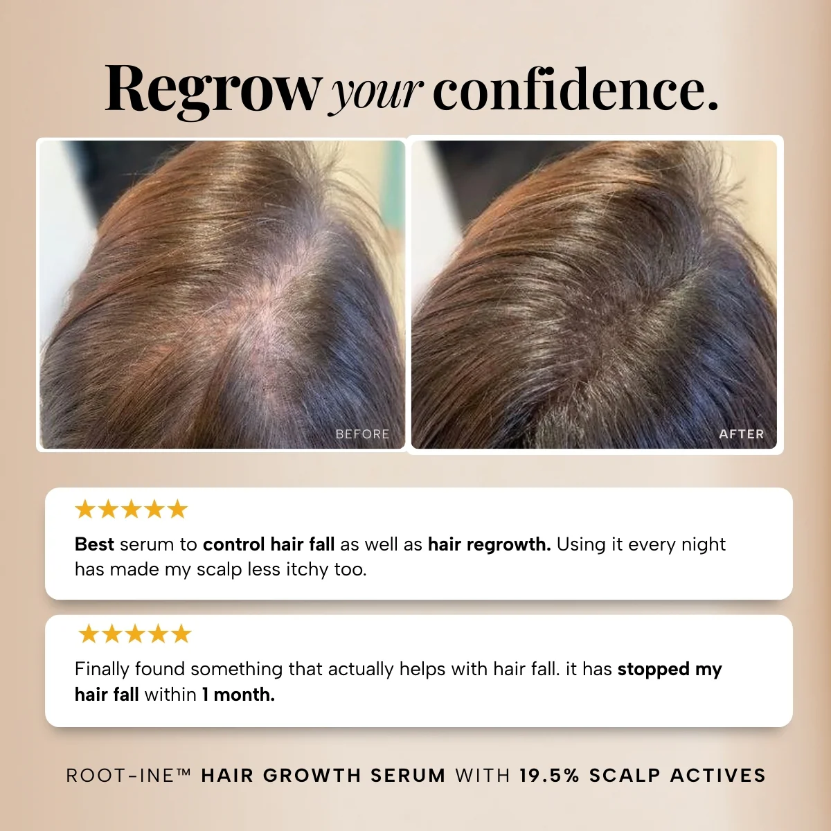 RAS™ Root-ine™ Hair Growth Serum with 19.5% Scalp Actives - Image 6