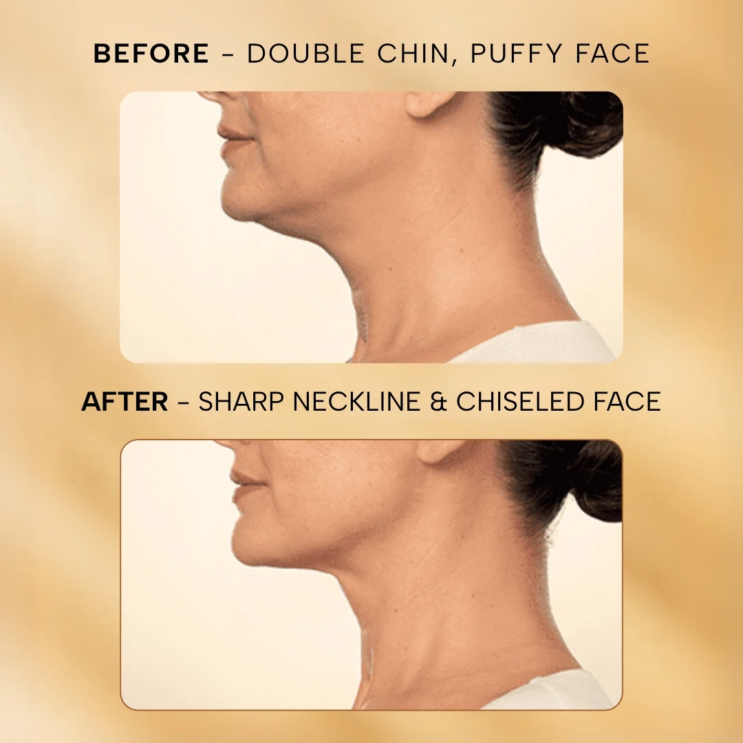Skin Lift Electric Facial & Neck Massager - Image 5