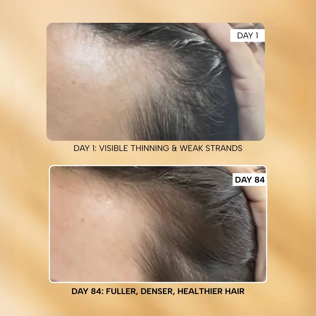 The Hair Root-ine™ Rescue Duo - Image 9